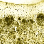 Origine (Mme D.) | Annecy | 10 février